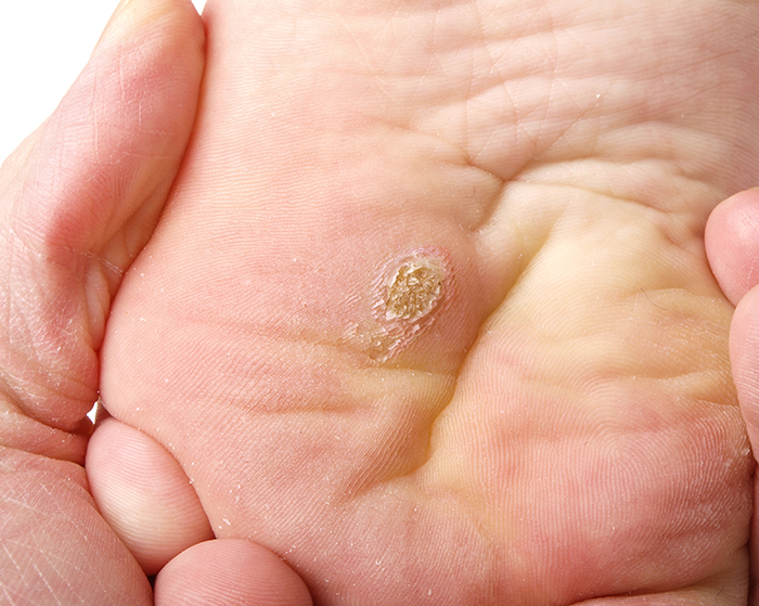 Dermatology